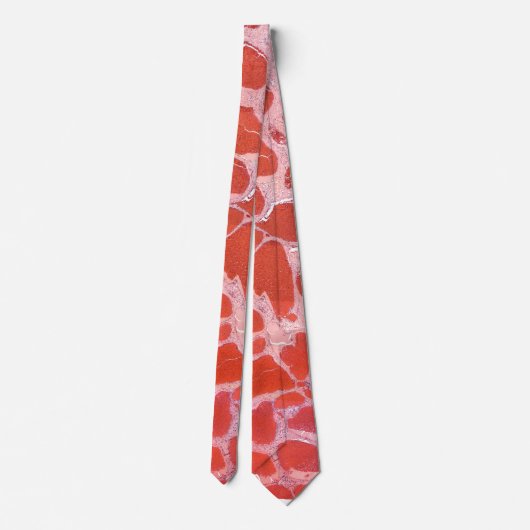 Pathologische Krawatte des Hämangioms (Rückseite)