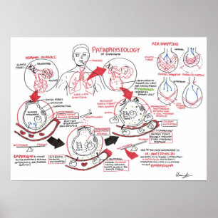 Pathophysiologie des Emphysemas Poster