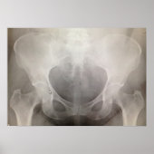 Pelvis-Röntgen Poster (Vorne)