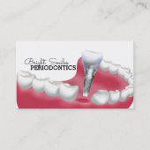 Periodontist Dentist Business Card Visitenkarte (Vorderseite)