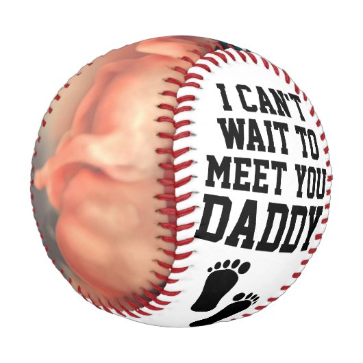 Personalisiert Sonogram Ultrasound New Daddy Baby Baseball (Schrägansicht)