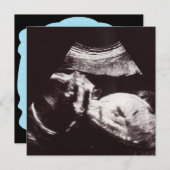 Personalisierte Ultraschallbild Babydusche Einladung (Vorne/Hinten)