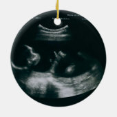 Personalized Whimsical Baby Announcement Ornament (Hinten)