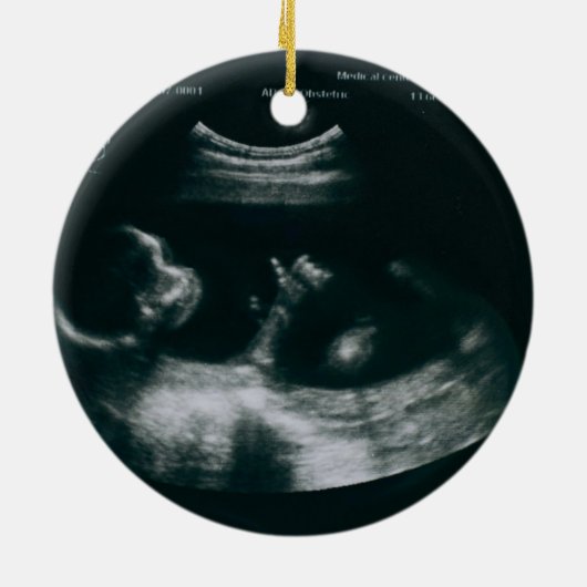 Personalized Whimsical Baby Announcement Ornament (Hinten)