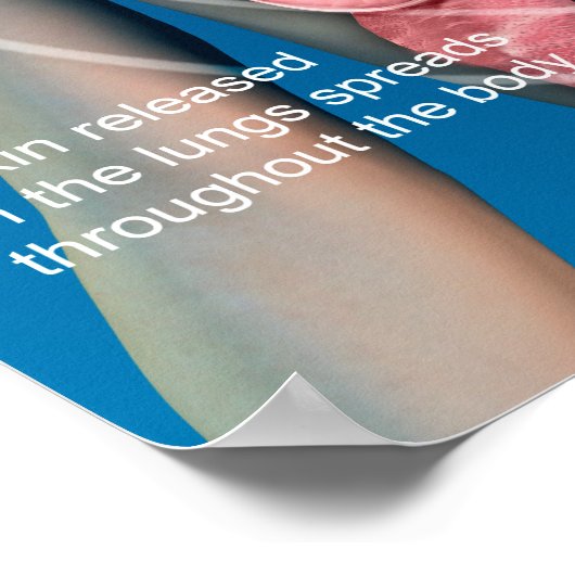 Pertussis (husten)-Poster Poster (Ecke)