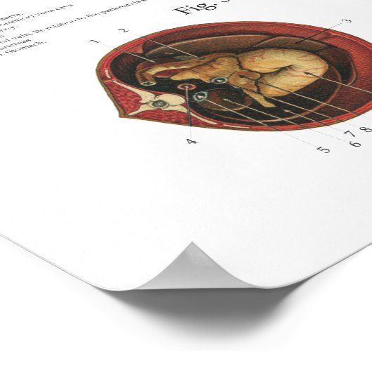 Pferdemuskeln Viscera Anatomie Poster Chart (Ecke)