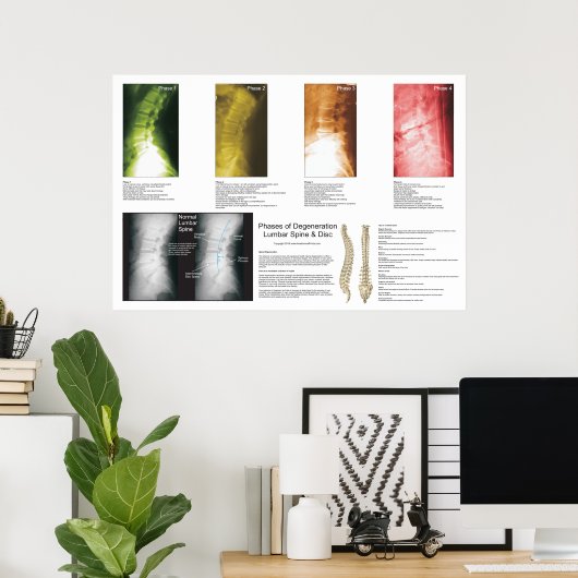 Phases Lumbar Spinal Degenerations Poster (Heimbüro)
