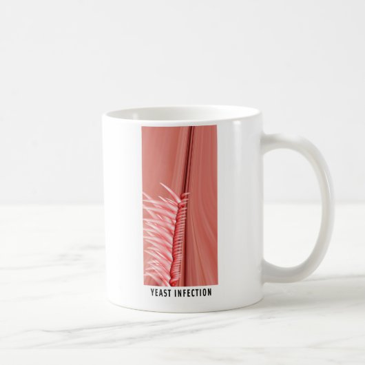 Pilzinfektion Kaffeetasse (Rechts)
