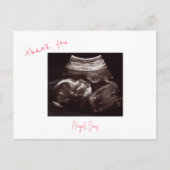 Pink Baby Dusche Ultrasound Danke Postkarte (Vorderseite)