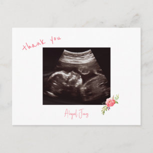 Pink Baby Dusche Ultrasound Niedlicher Schriftart  Postkarte