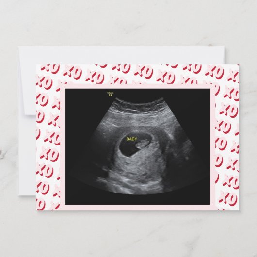 Pink Oma Valentine Ultrasound Schwangerschaft Ankündigung (Rückseite)