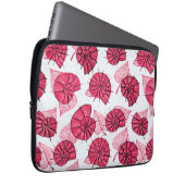Pink Snails Muster Girly Zoology Laptopschutzhülle (Vorne Rechts)
