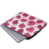 Pink Snails Muster Girly Zoology Laptopschutzhülle (Vorne Knopf)