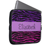Pink Zebra, Lila Zebra, Glitzer Zebra, Ihr Name Laptopschutzhülle (Vorne Rechts)