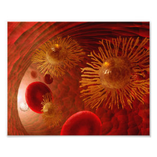 Plakat zur Krebsmetastasierung Fotodruck