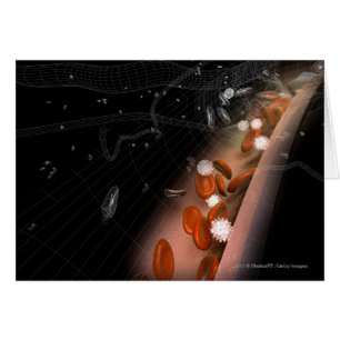 Plakette in den Arterien