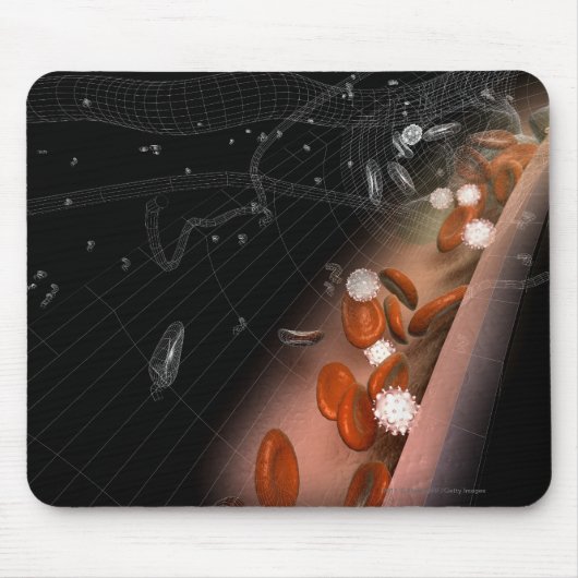 Plakette in den Arterien Mousepad (Vorne)