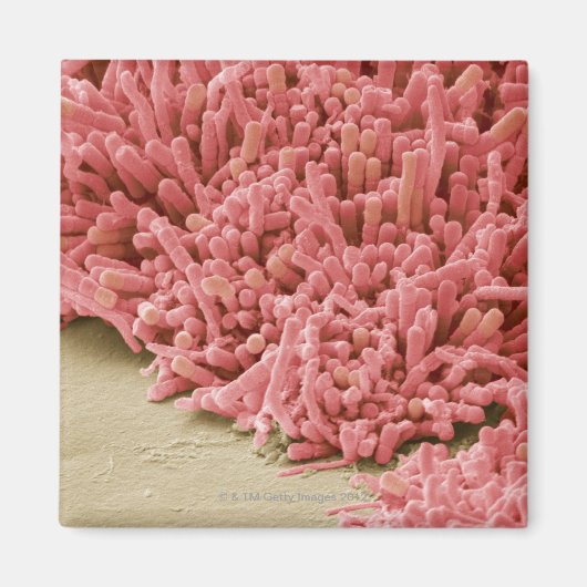 Plaque bildende Bakterien, farbiges Scannen Magnet (Vorne)