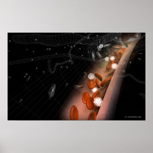 Plaque in den Arterien Poster