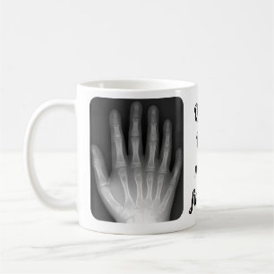 Polydactyl Handröntgenstrahl Kaffeetasse