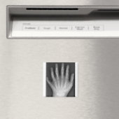 Polydaktylie, Sechs gefederte Hand, X-Ray, Seltenh Magnet (In Situ (Geschirrspüler))