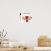 Poster des weiblichen Fortpflanzungssystems (Küche)