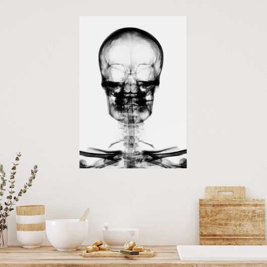 POSTER/DRUCKER X-RAY VISION SKELETON SKULL - B&W POSTER (Küche)