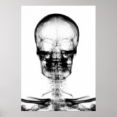 POSTER/DRUCKER X-RAY VISION SKELETON SKULL - B&W POSTER (Vorne)
