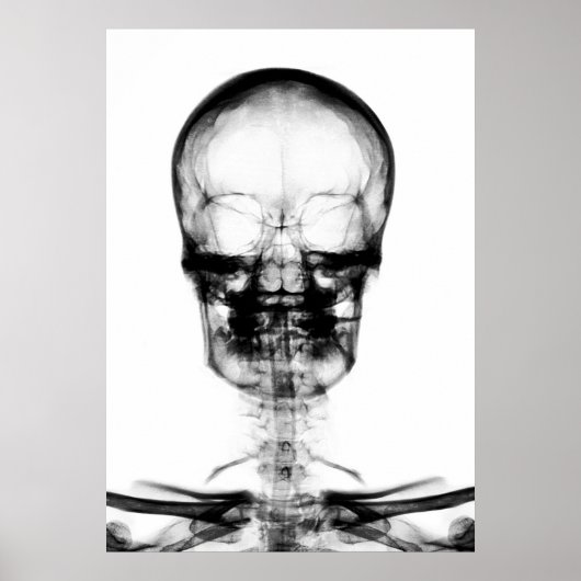 POSTER/DRUCKER X-RAY VISION SKELETON SKULL - B&W POSTER (Vorne)