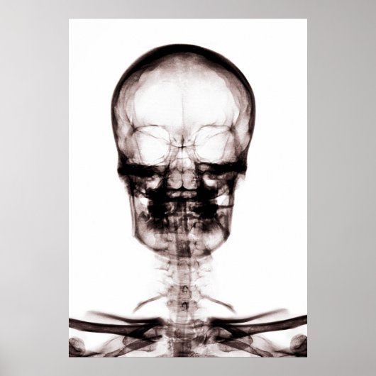 POSTER/DRUCKER X-RAY VISION SKELETON SKULL ORIG/NE POSTER (Vorne)