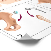 Poster für angesagte Ersetzung der Operation insge (Ecke)