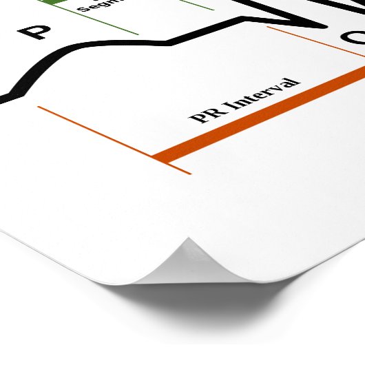 Poster Sinus Rhythm EKG-Diagramm (Ecke)