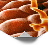 Powdery Mildew Fungus on Poinsettia Poster (Ecke)