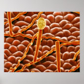 Powdery Mildew Fungus on Poinsettia Poster (Vorne)