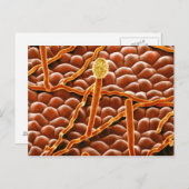 Powdery Mildew Fungus on Poinsettia Postkarte (Vorne/Hinten)