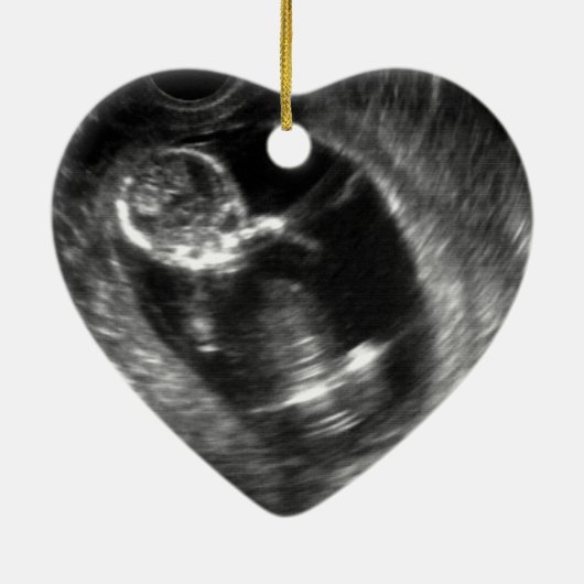 Pregnancy Announcement Custom Grandma Aunt Gift Keramik Ornament (Hinten)