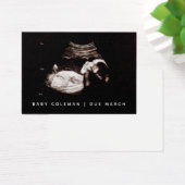 Pregnancy Announcement Sonogram Mini Card Pack (Schreibtisch)