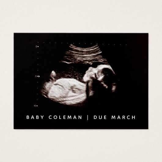 Pregnancy Announcement Sonogram Mini Card Pack (Vorderseite)