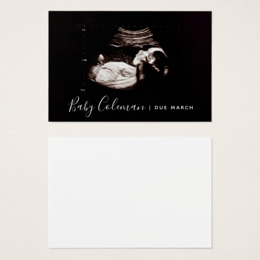 Pregnancy Anuncement Sonogram Mini Card (Vorne & Hinten)