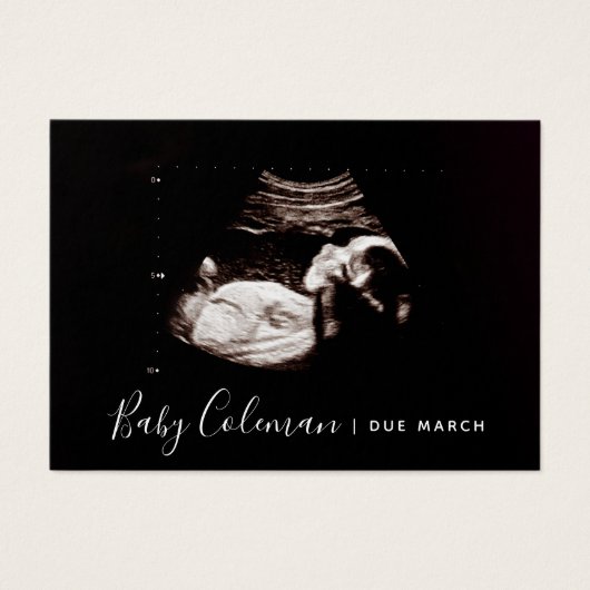 Pregnancy Anuncement Sonogram Mini Card (Vorderseite)