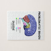 Problematisches Gehirn-Innere (Gehirn-Anatomie) Puzzle (Horizontal)