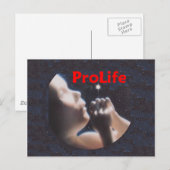 ProLife Postkarte (Vorne/Hinten)