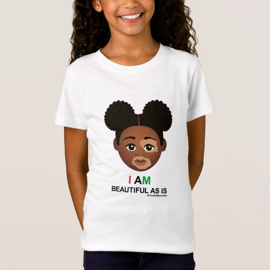 #Proud2BNaturalMe #BeautifulAsis #Vitiligo T-Shirt (Vorderseite)