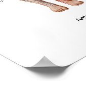 Pulmonary Embolism, Pathway Of Embolus Poster (Ecke)