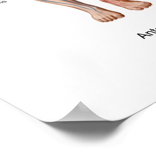 Pulmonary Embolism, Pathway Of Embolus Poster (Ecke)