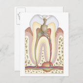 Puls und Wurzelabszess Postkarte (Vorne/Hinten)