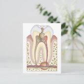 Puls und Wurzelabszess Postkarte (Stehend Vorderseite)