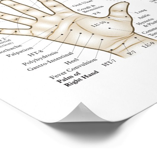 Punkteplakat für akupunktive Mikrosystempunkte Poster (Ecke)