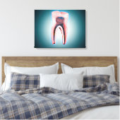 Querschnitt eines menschlichen Zahnes Leinwanddruck (Insitu (Schlafzimmer))