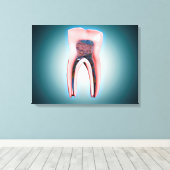 Querschnitt eines menschlichen Zahnes Leinwanddruck (Insitu (Holzboden))